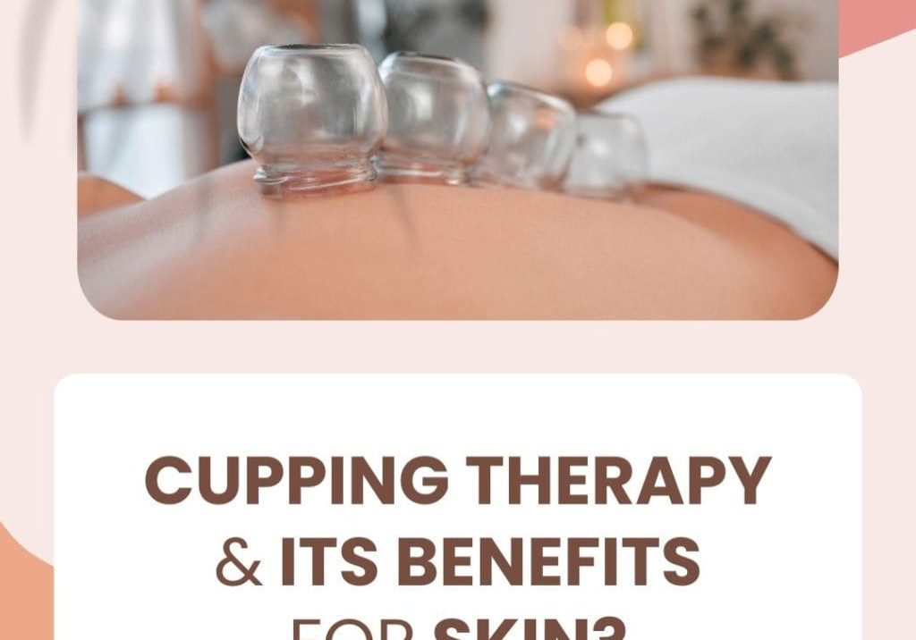 Cupping Therapy Benefit