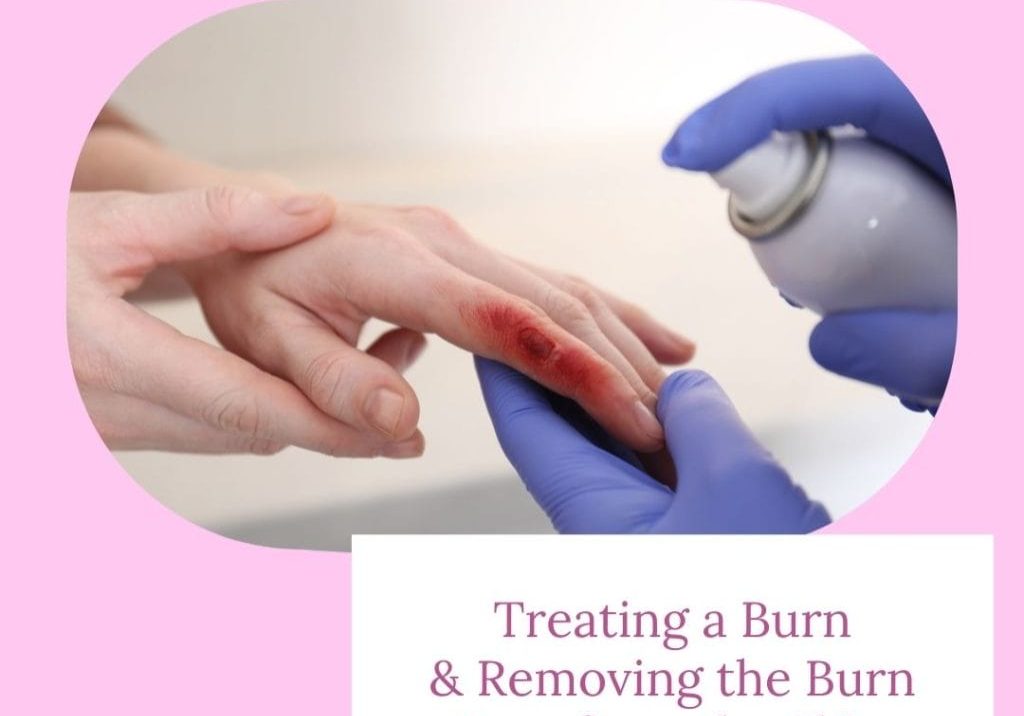 Treat a Burn and How to Remove